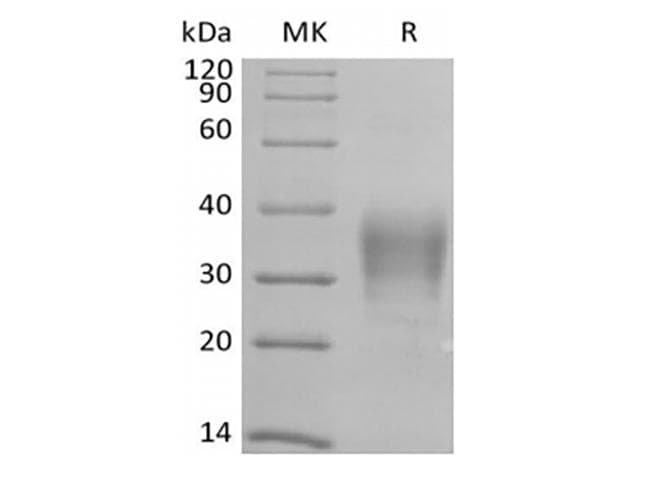Human CD79B / CD79 Beta Protein (Recombinant AVI-6His, C-terminus)