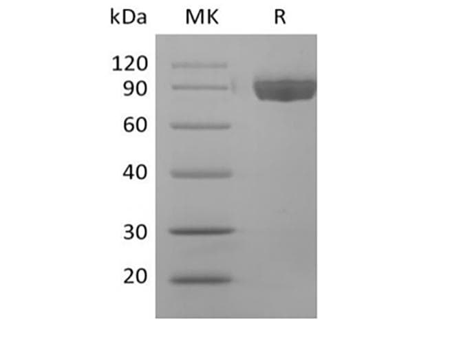 Human AFM / Afamin Protein (Recombinant 6His, C-terminus)