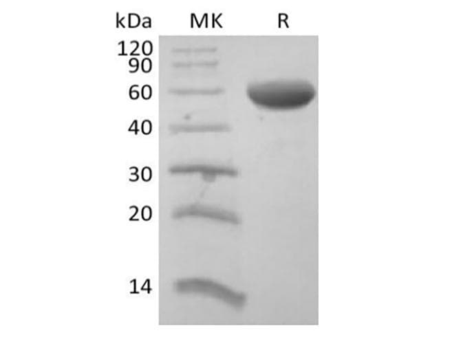 Human CD8B / CD8 Beta Protein (Recombinant Fc, C-terminus)