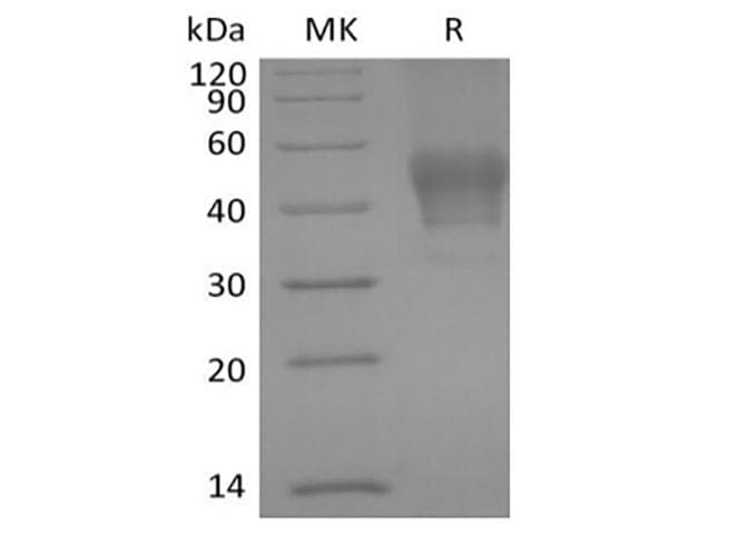 Human CD24 Protein (Recombinant Mouse IgG Fc, C-terminus)