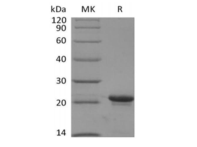 Human KRAS Protein (Recombinant 6His, N-terminus)