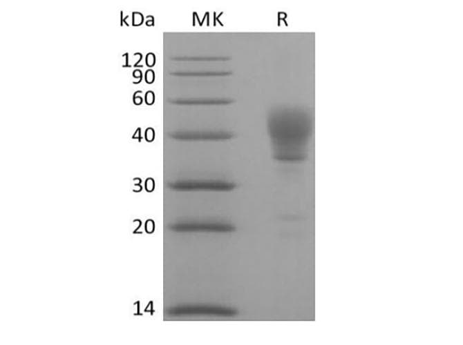 Human CD24 Protein (Recombinant Fc, C-terminus)