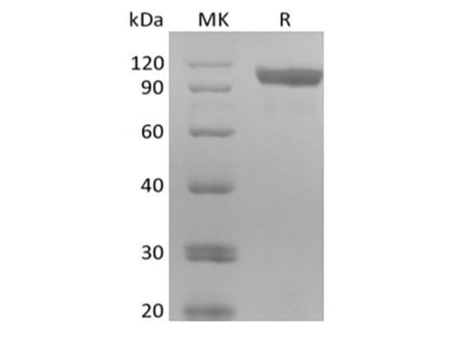 Human ERBB3 / HER3 Protein (Recombinant AVI-6His, C-terminus)
