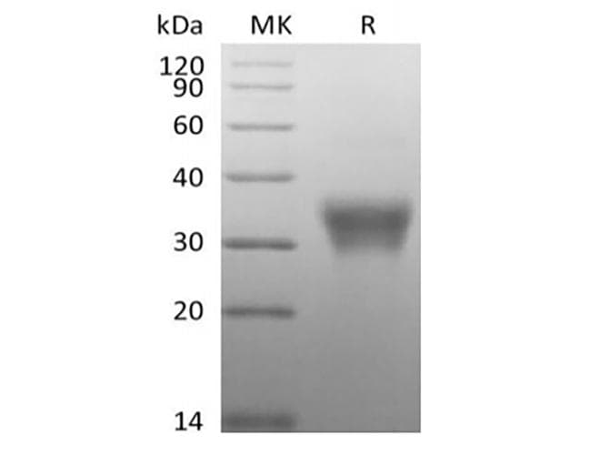 Human CD7 Protein (Recombinant AVI-6His, C-terminus)