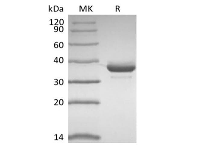 Human CD81 Protein (Recombinant Fc, N-terminus)