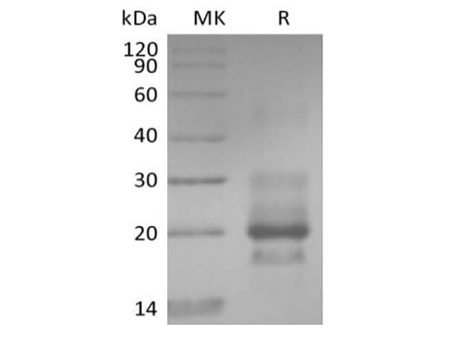 Human TNFRSF10A / DR4 Protein (Recombinant 6His, C-terminus)