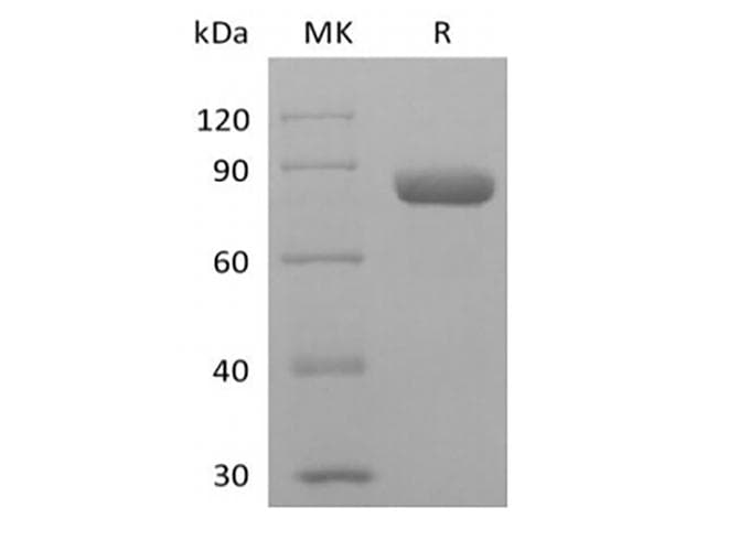 Human PVRL2 / CD112 Protein (Recombinant Mouse IgG2a Fc, C-terminus)