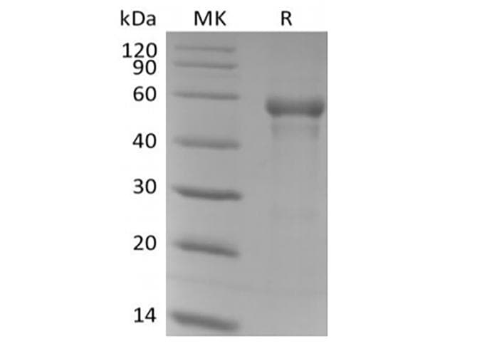 Human B3GAT1 Protein (Recombinant 6His, N-terminus)