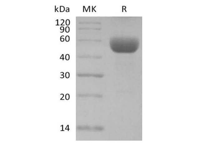 Mouse CD79B / CD79 Beta Protein (Recombinant Fc, C-terminus)