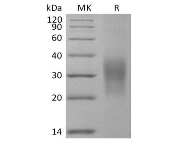 Sectm1A-Ab (Mouse) Protein (Recombinant 6His, C-terminus)