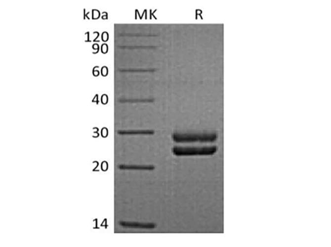 Sheep PRL / Prolactin Protein (Recombinant 6His, C-terminus)
