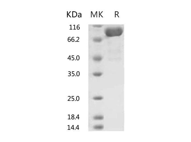 Human ACE2 / ACE-2 Protein (Recombinant 6His, C-terminus)