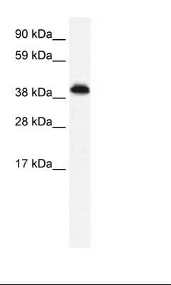 Polyclonal Rabbit anti-Human ZNF568 Antibody (FITC, aa143-192, WB)
